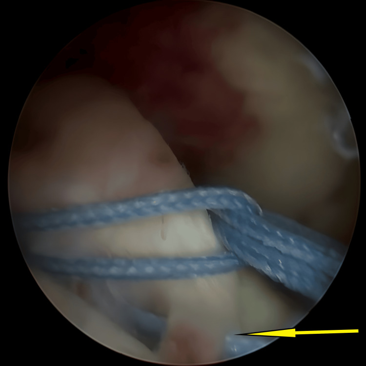 Figure 9