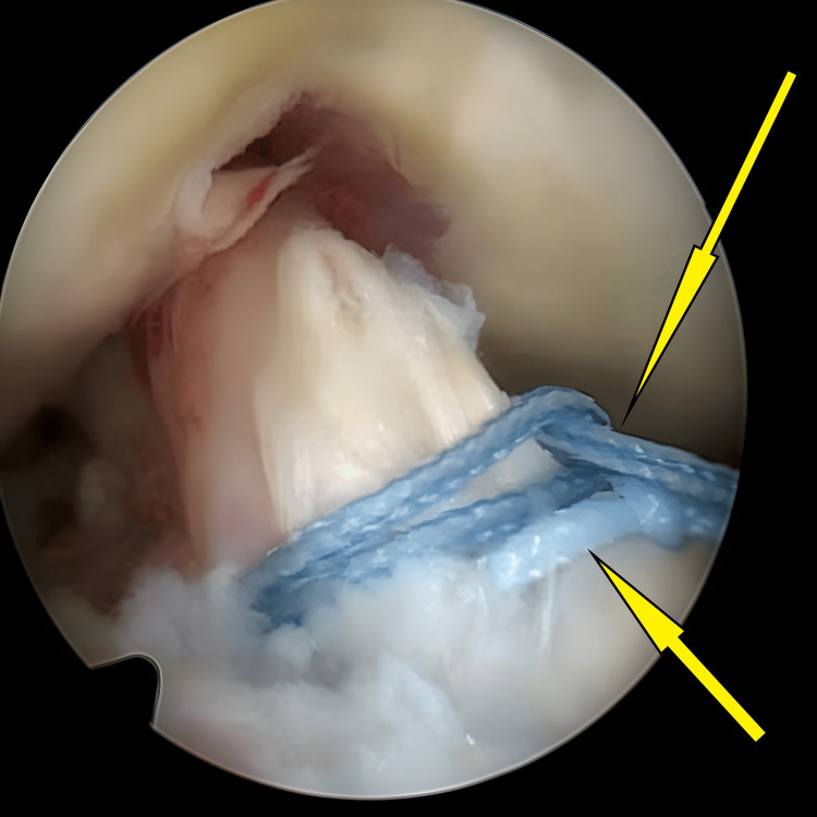 Figure 10