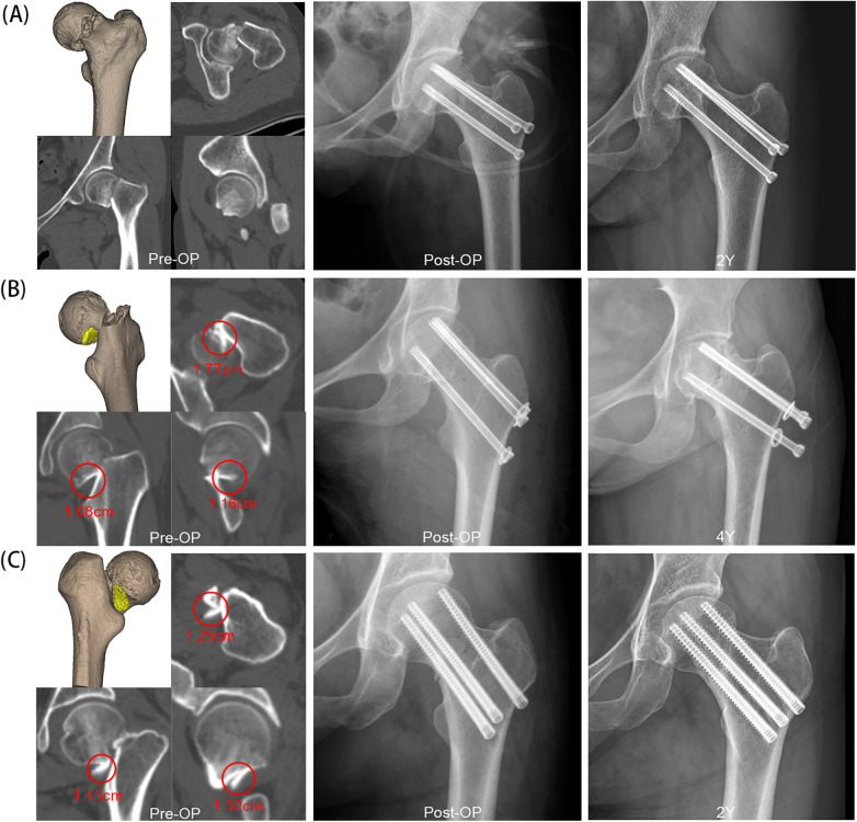 Figure 2