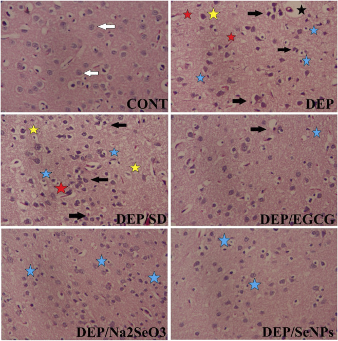 Figure 11