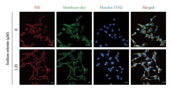Figure 11