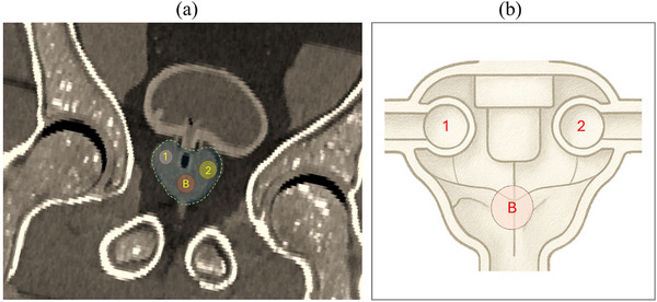 Figure 8