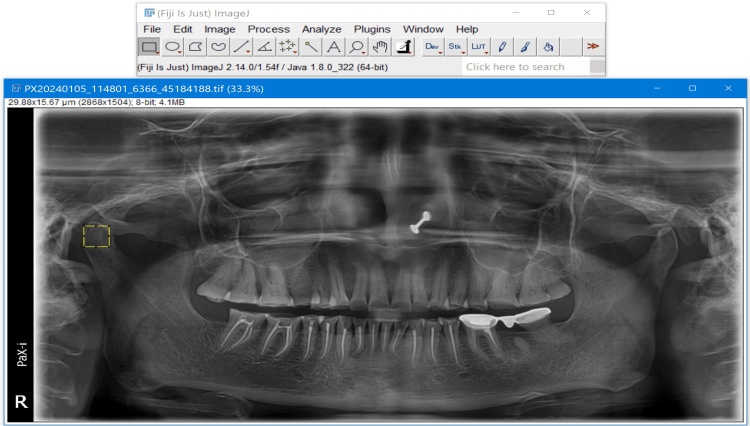 Figure 2