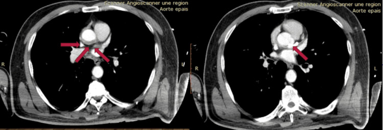 Figure 6