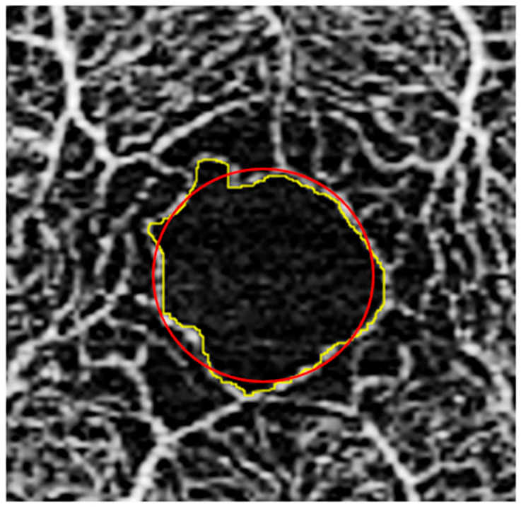 Figure 4
