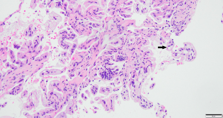 Figure 9