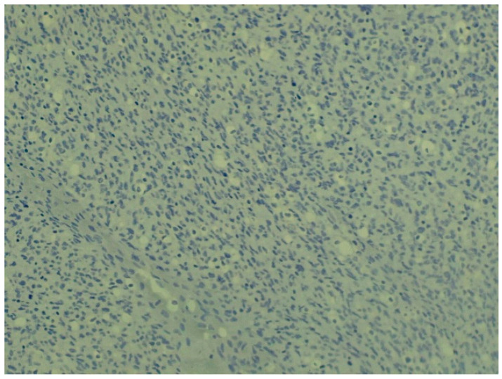 Figure 9