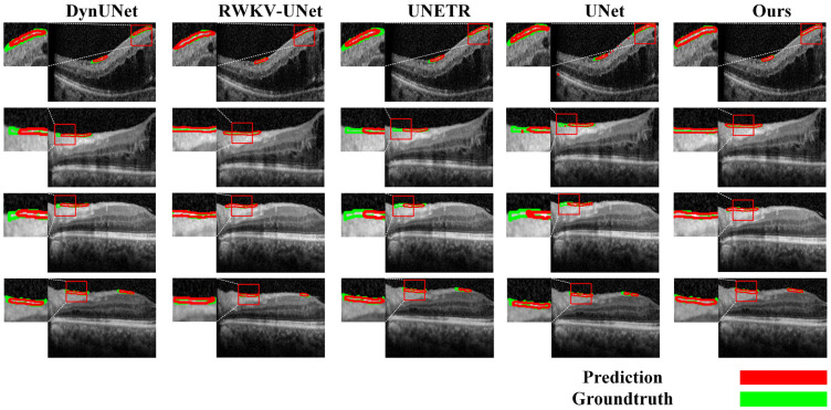 Figure 11