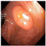 Figure 35