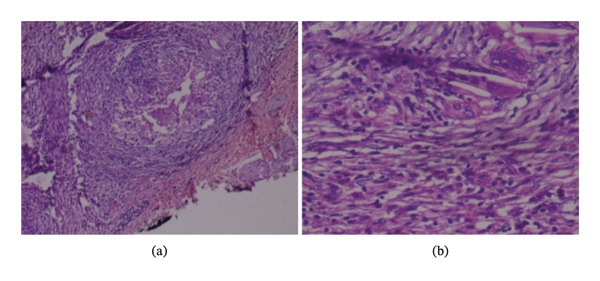 Figure FIGURE 2