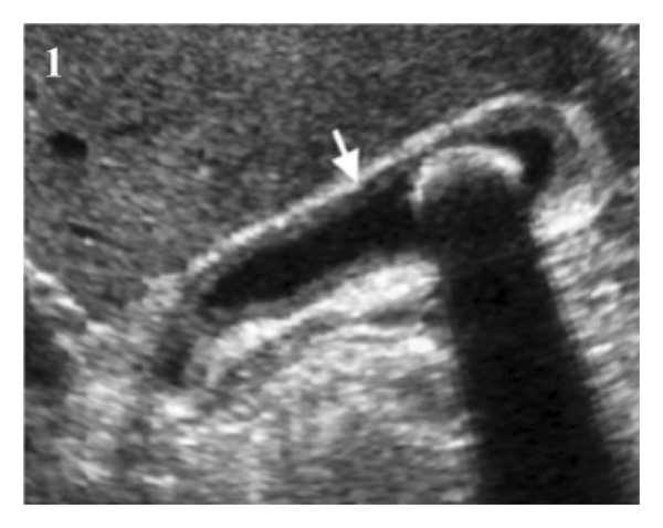 Figure FIGURE 1