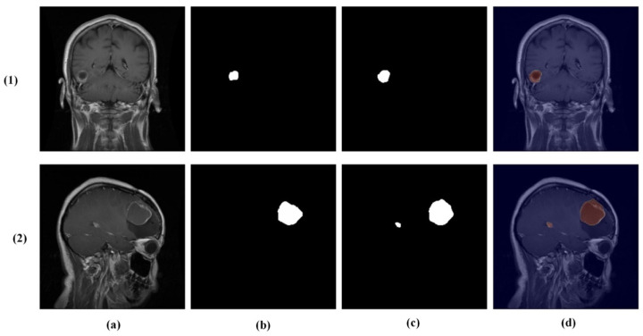 Figure 11