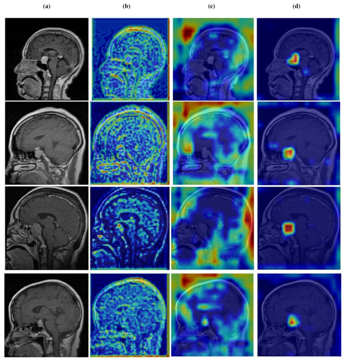 Figure 15