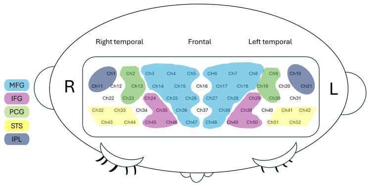 Figure 4