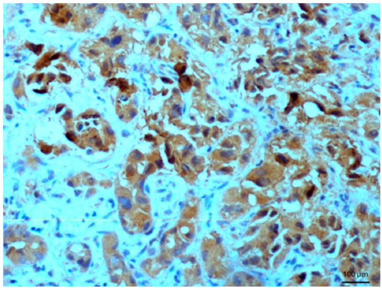 Figure 11