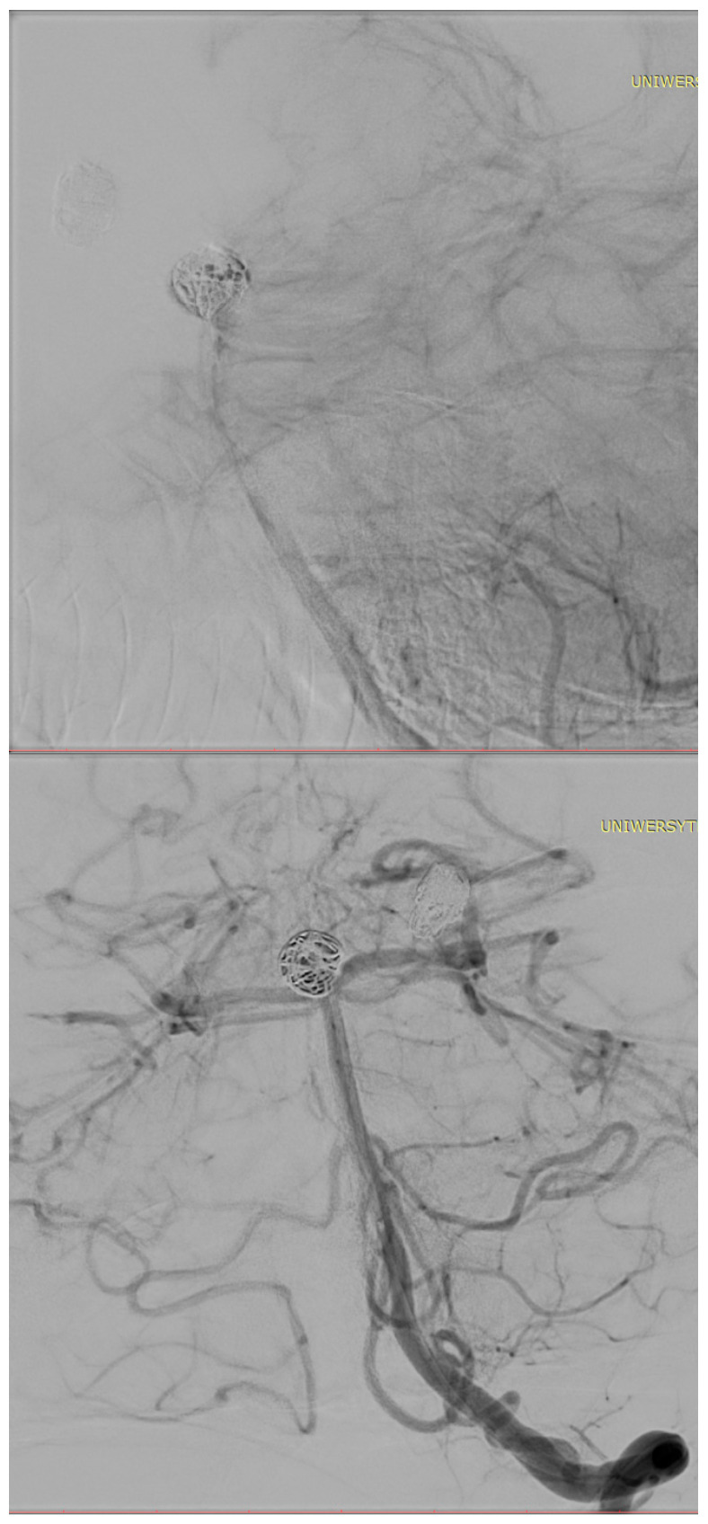 Figure 10
