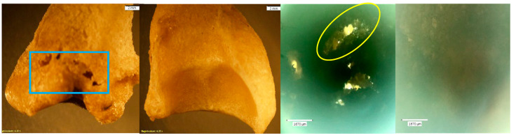 Figure 11