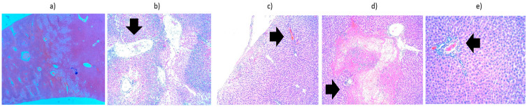Figure 11