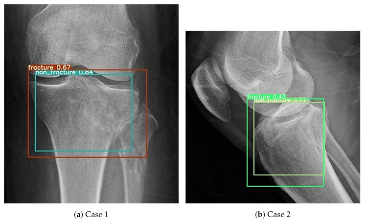 Figure 16