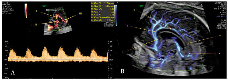 Figure 6