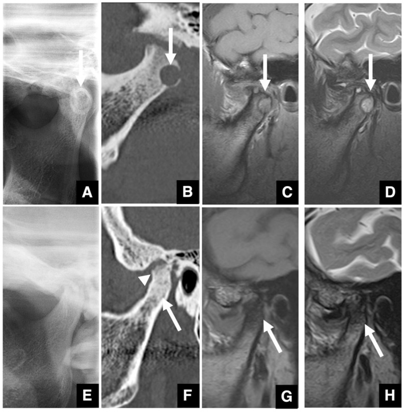 Figure 14