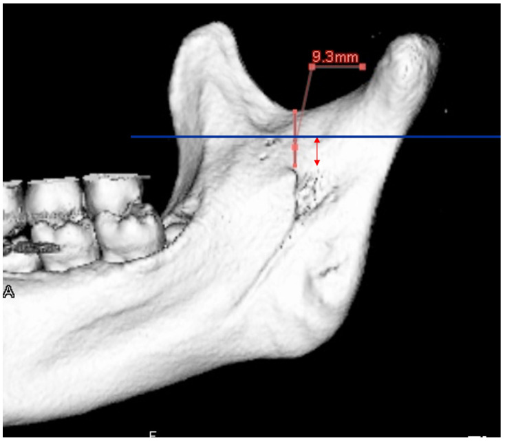 Figure 17