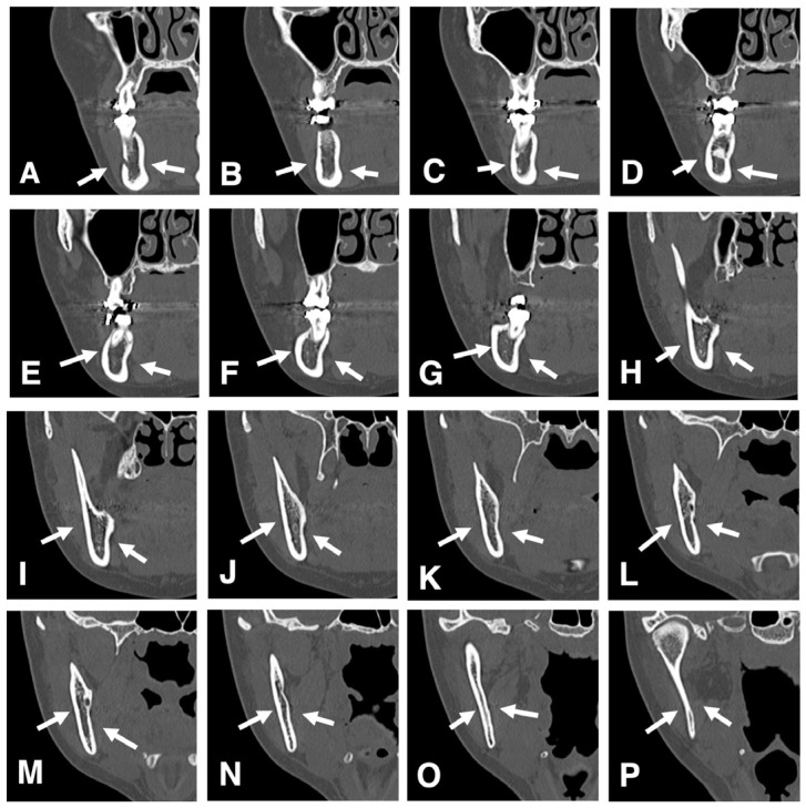 Figure 18