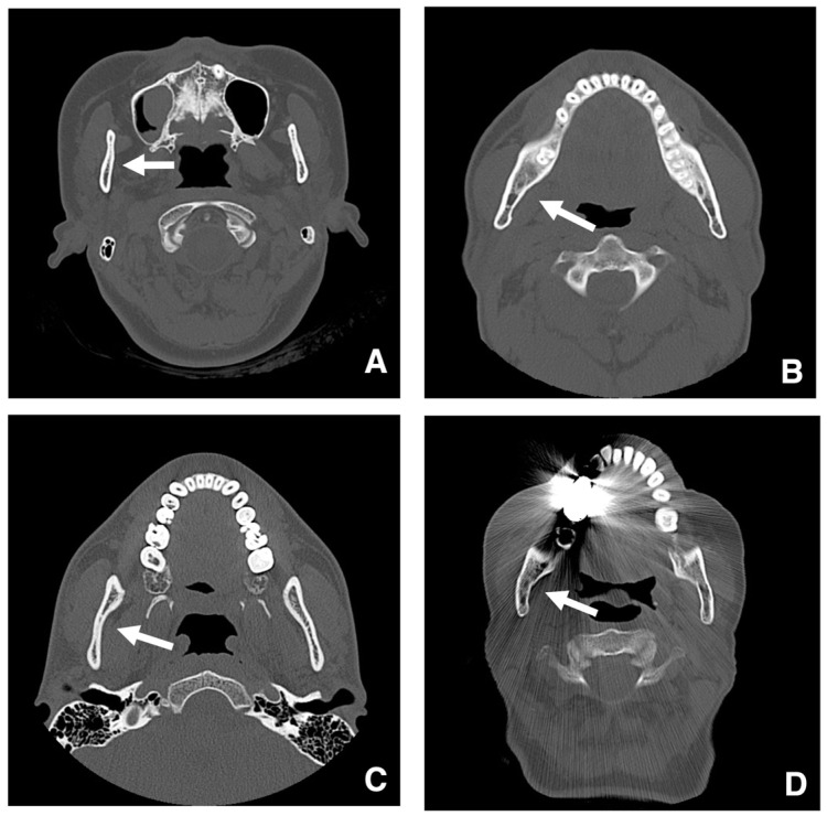 Figure 20