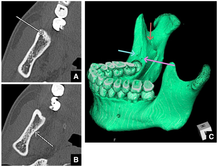 Figure 21
