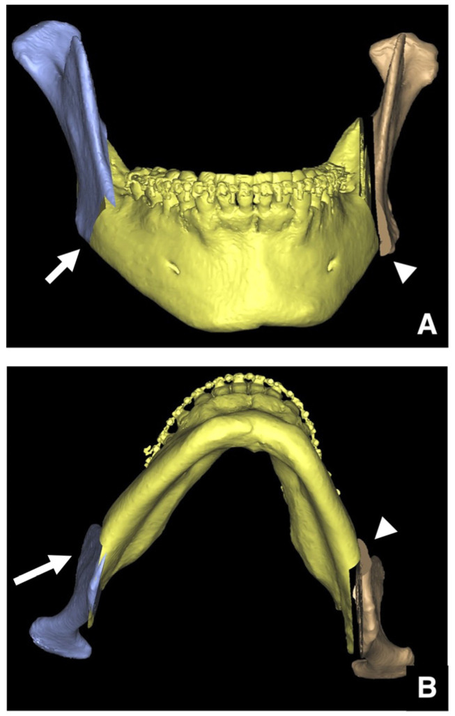 Figure 22