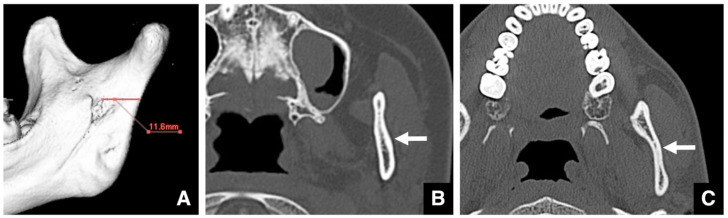 Figure 23