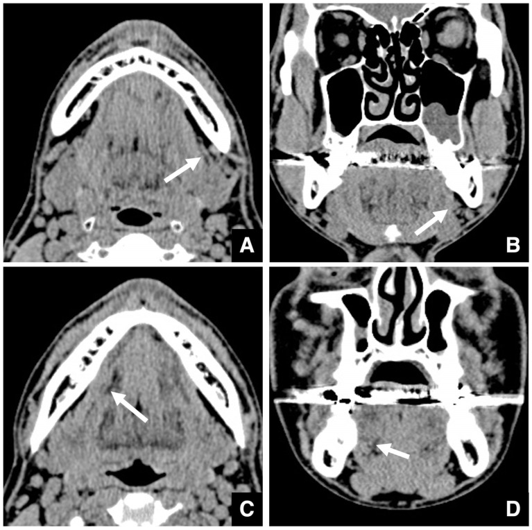 Figure 24