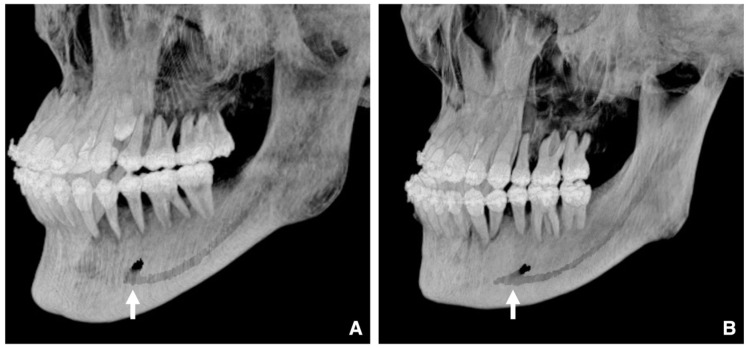 Figure 25