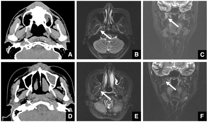 Figure 26