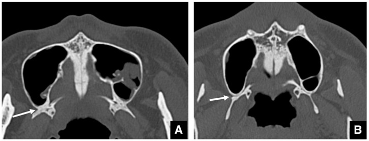 Figure 27