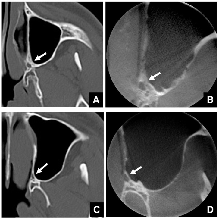 Figure 28
