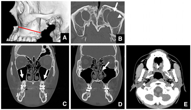 Figure 29