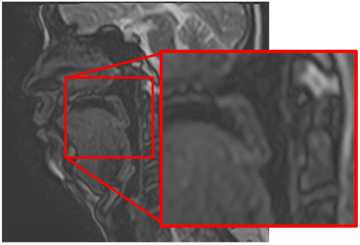 Figure 30