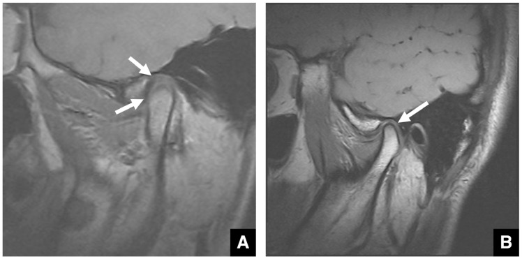 Figure 31
