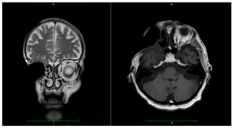 Figure 17