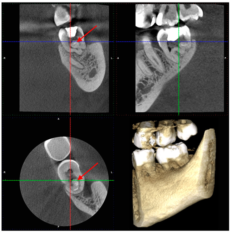 Figure 6