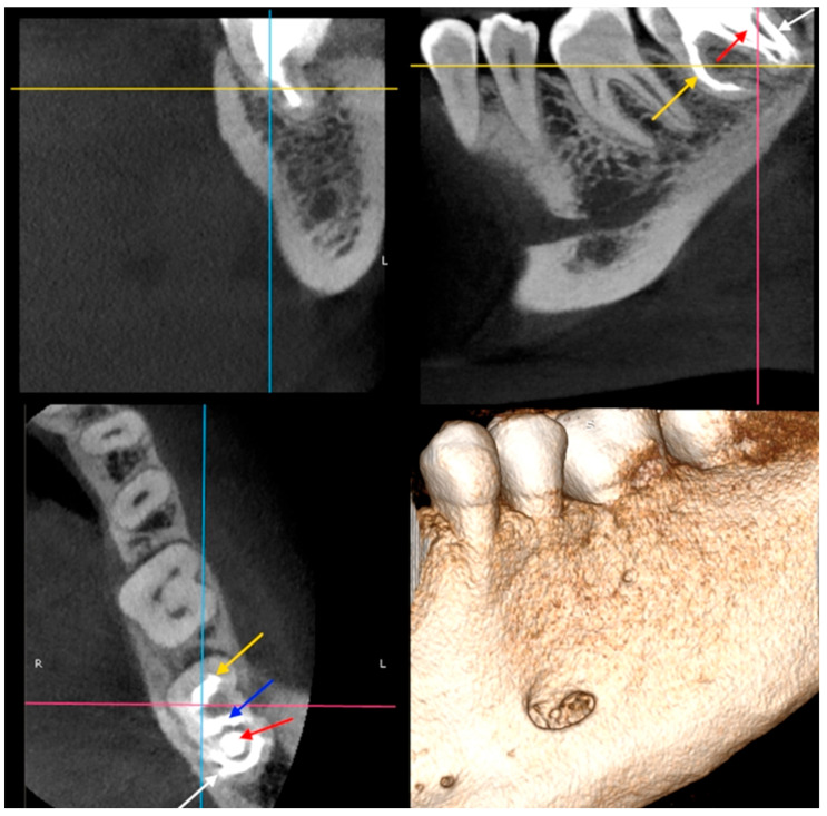 Figure 10