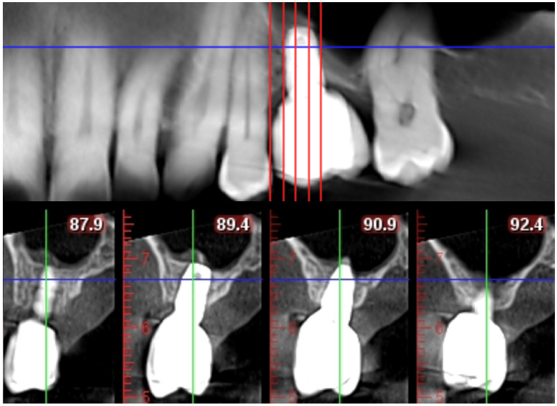 Figure 5