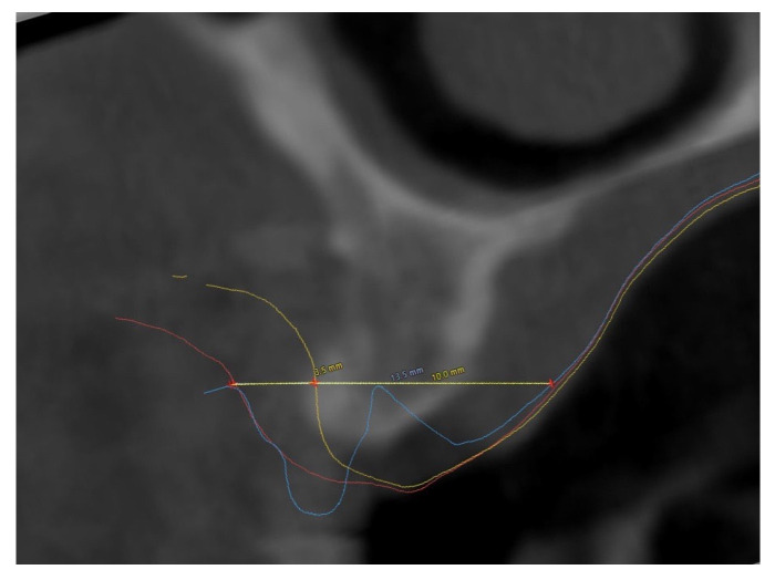Figure 6