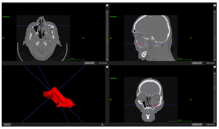 Figure 2