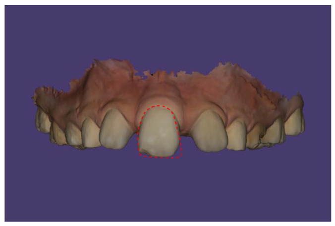 Figure 10