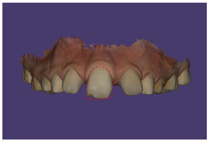 Figure 11