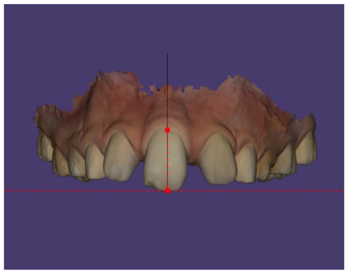 Figure 12