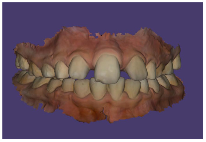 Figure 14