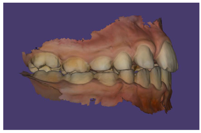 Figure 15